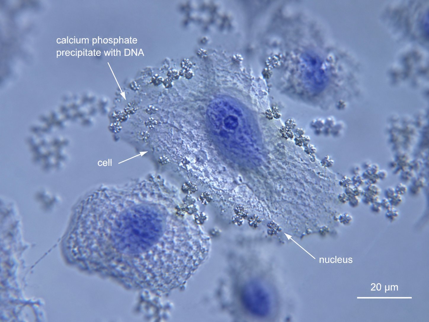 Micrograph of 293 cells with calcium phosphate precipitate and DNA during transfection